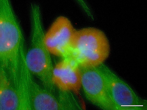 Fluorescence microscopy image showing a ternary anaphase in NZM12